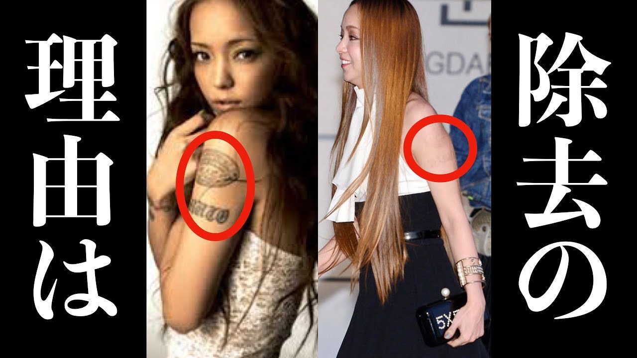 십 년 넘은 타투, 지우기로 한 이유
