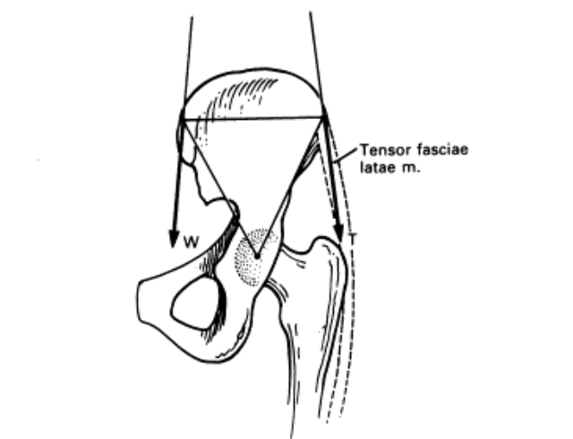 대퇴근막장근(Tensor fascia lata)