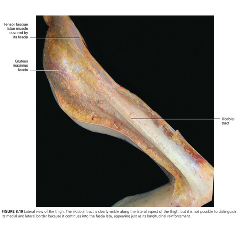 대퇴근막장근(Tensor fascia lata)