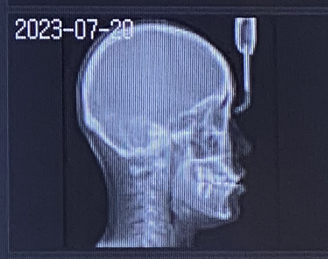 대나무숲 에세이