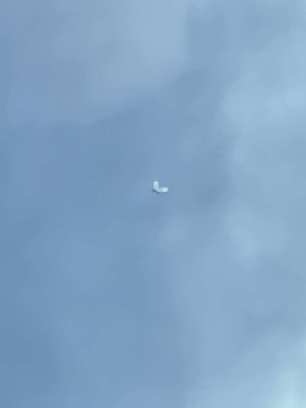 똥꼬에서트림이나오면