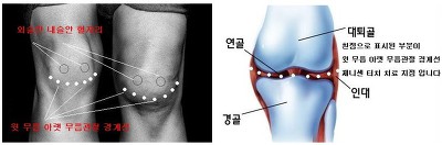 ▶️배드민턴 스트레스 해소''기술 연습 방법은? *나무는 뿌리가 먼저 늙고, *사람은 다리가 먼저 늙는다!