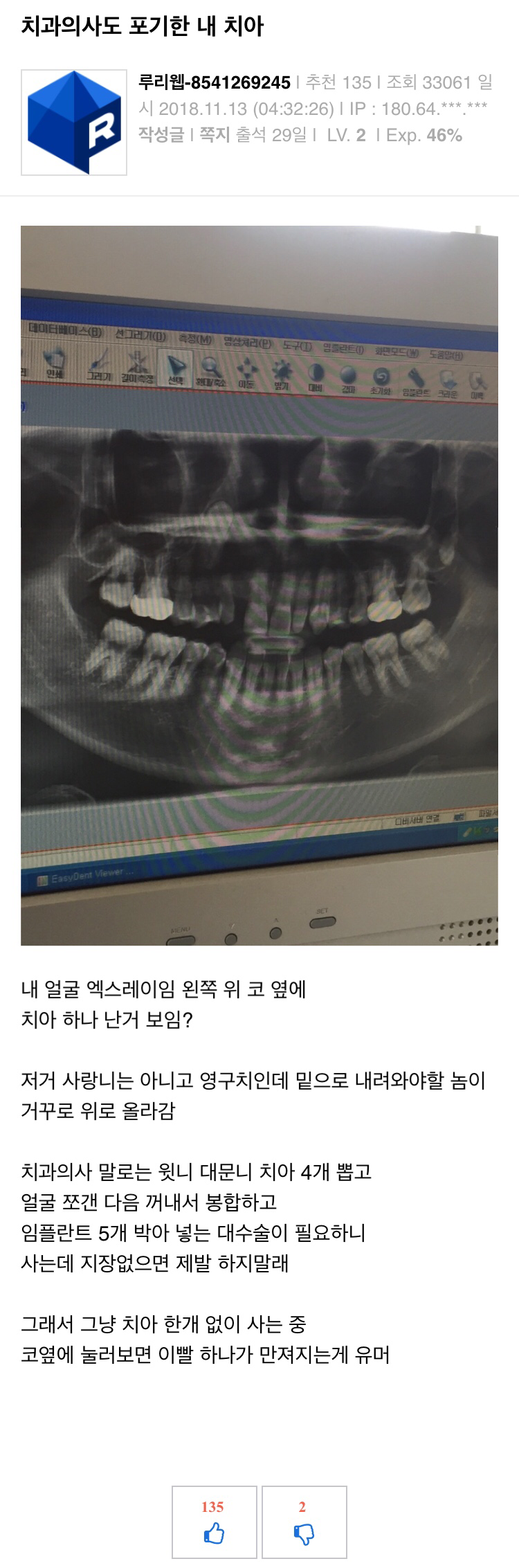 치과의사도 포기한 치아.jpg | 인스티즈