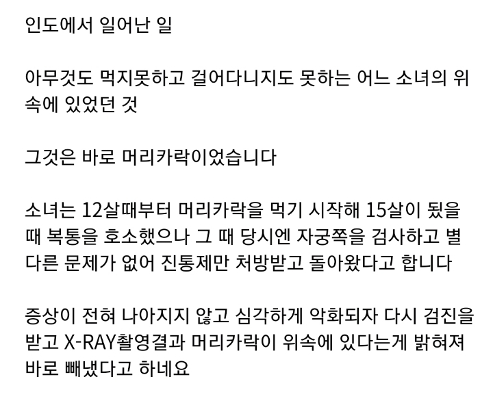 위 속에서 나온 1kg의 머리카락 | 인스티즈