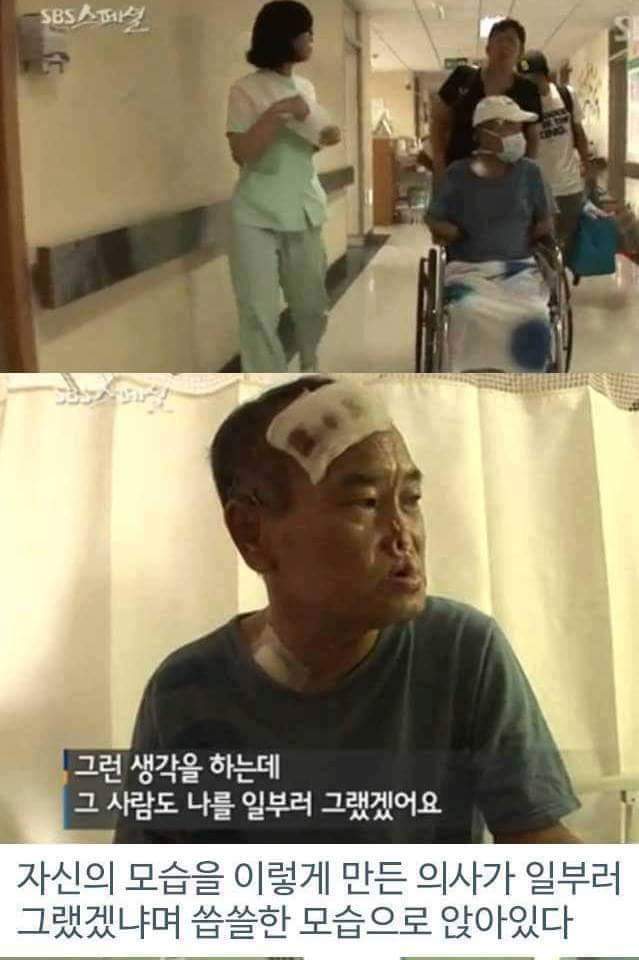 병원의 실수로 하루아침에 사지절단 된 가장 | 인스티즈