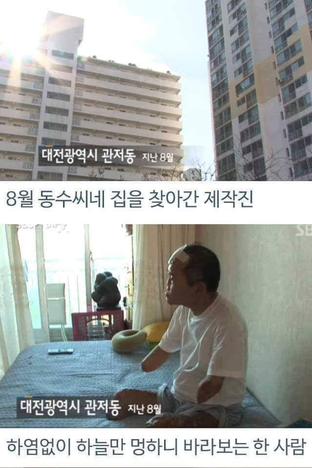 병원의 실수로 하루아침에 사지절단 된 가장 | 인스티즈