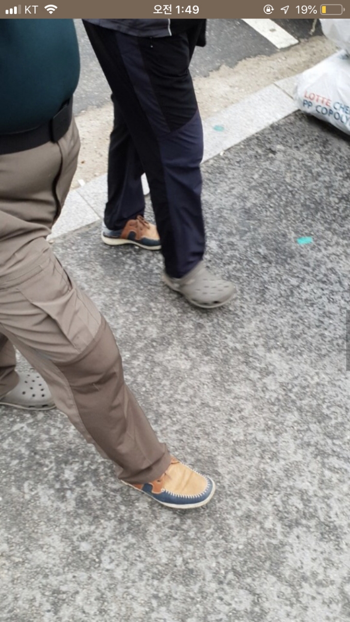 나 죽고싶어 보톡하는줄도 모르고 오줌쌌어..ㄷㄷ..JPG | 인스티즈