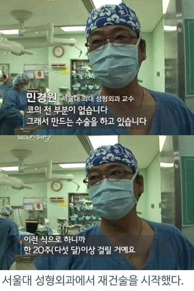 병원의 실수로 하루아침에 사지절단 된 가장 | 인스티즈