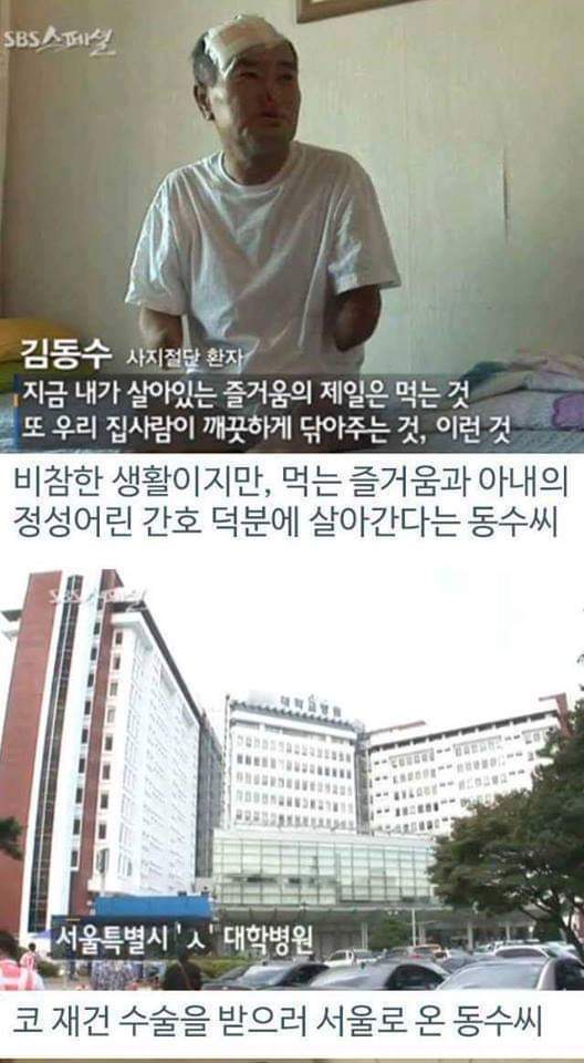 병원의 실수로 하루아침에 사지절단 된 가장 | 인스티즈