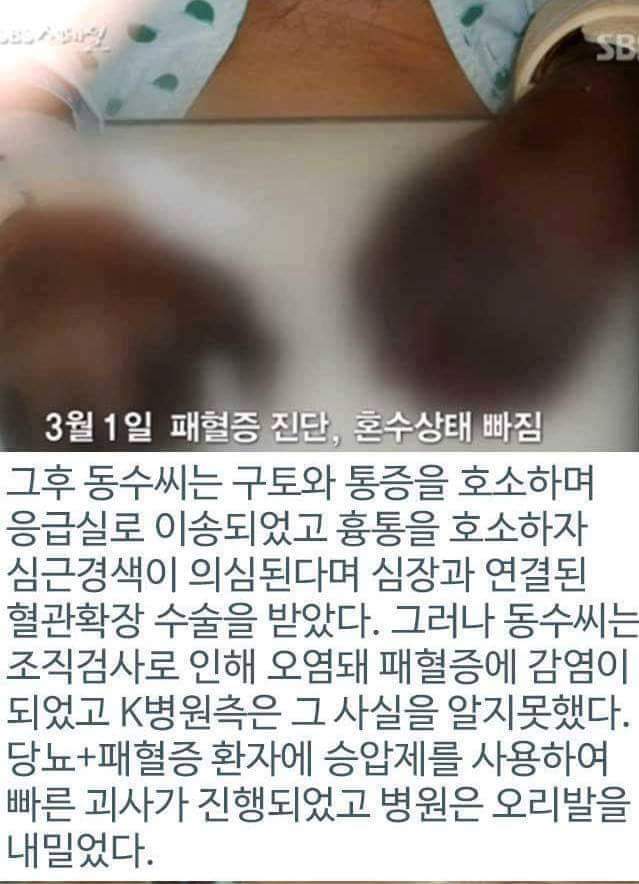 병원의 실수로 하루아침에 사지절단 된 가장 | 인스티즈