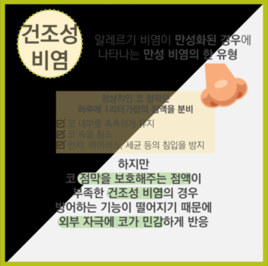 겉으론 티 안나는데 진짜 X같은 코 질환 | 인스티즈