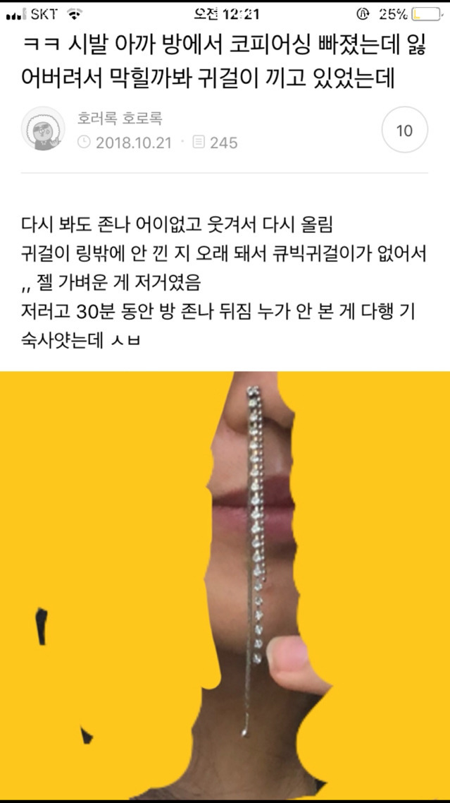 나 죽고싶어 보톡하는줄도 모르고 오줌쌌어..ㄷㄷ..JPG | 인스티즈