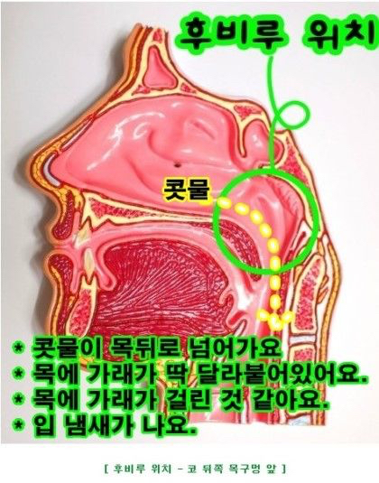 겉으론 티 안나는데 진짜 X같은 코 질환 | 인스티즈
