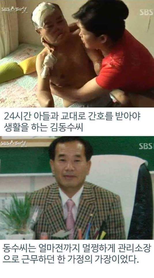 병원의 실수로 하루아침에 사지절단 된 가장 | 인스티즈