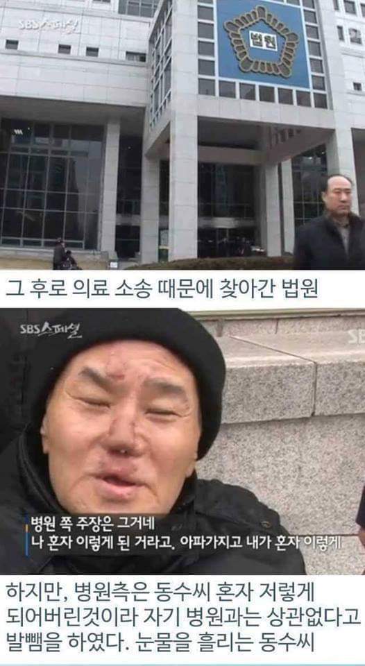 병원의 실수로 하루아침에 사지절단 된 가장 | 인스티즈