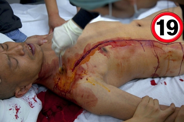 1미터의 민주주의 (사진주의) | 인스티즈