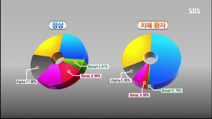 바이온스 이미지