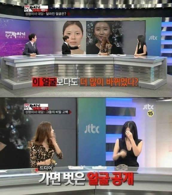 얼굴을 한 두 번 건드리면 안되는 이유 | 인스티즈