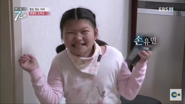 평생 웃으면서 살아야 하는 병 | 인스티즈