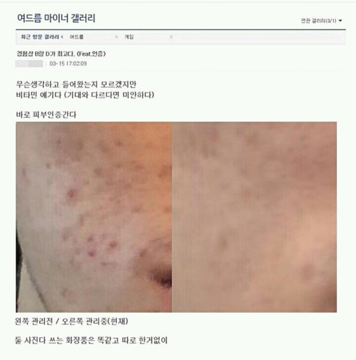 경험상 B와D가 최고다 (feat.인증) | 인스티즈