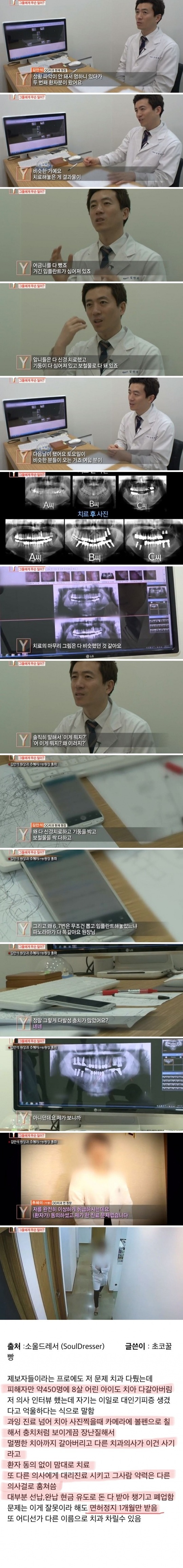 치과의사들도 충격 받은 진료사진.jpg | 인스티즈