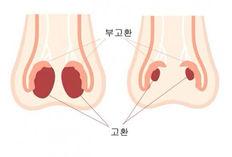 로이더 한 사람들의 고환 | 인스티즈