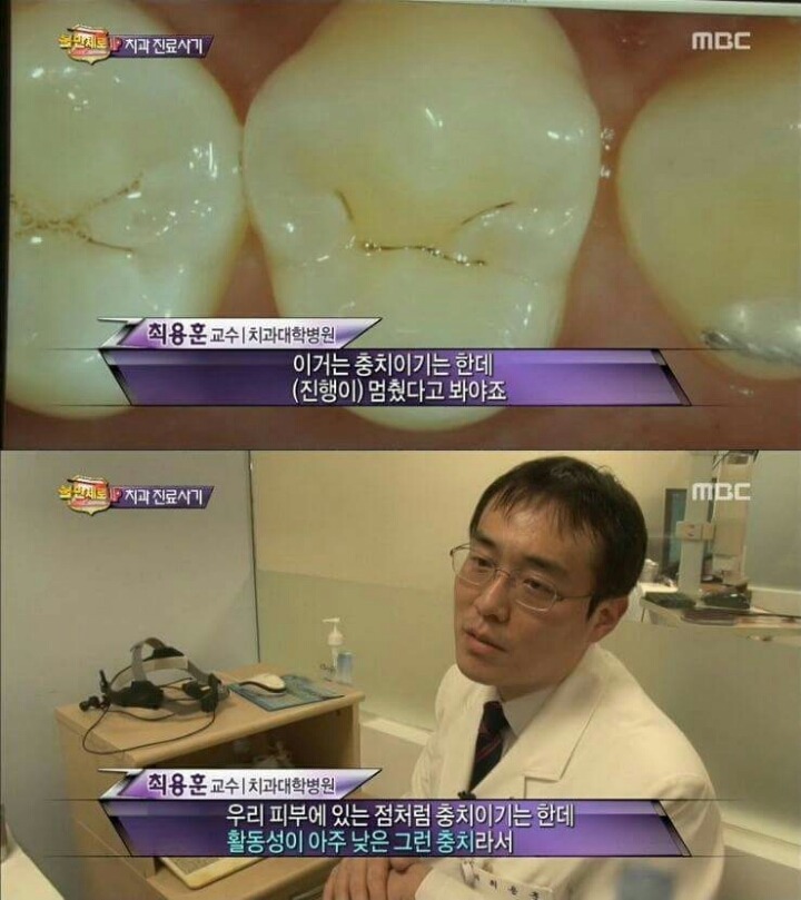 치과의사기꾼들에게 호갱 안 당하는 법 | 인스티즈