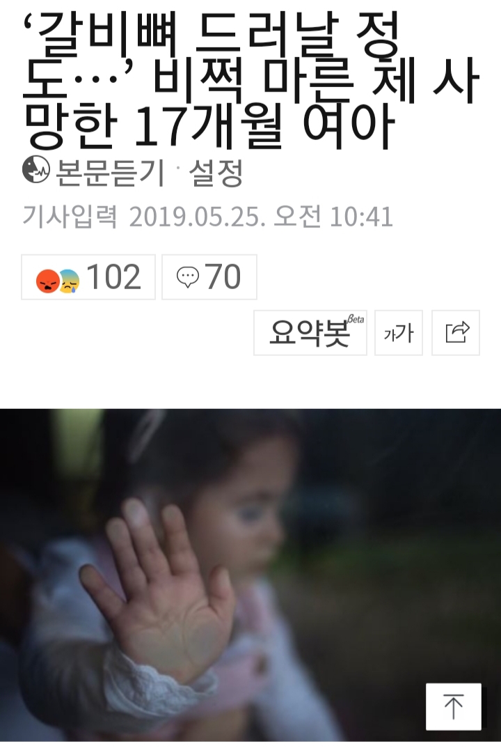 '갈비뼈 드러날 정도…' 비쩍 마른 체 사망한 17개월 여아 | 인스티즈