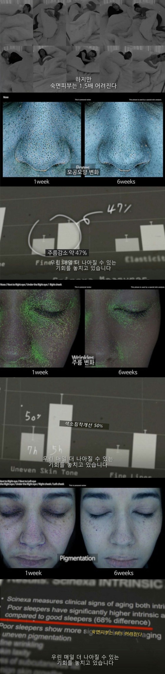 수면이 외모에 미치는 영향 | 인스티즈
