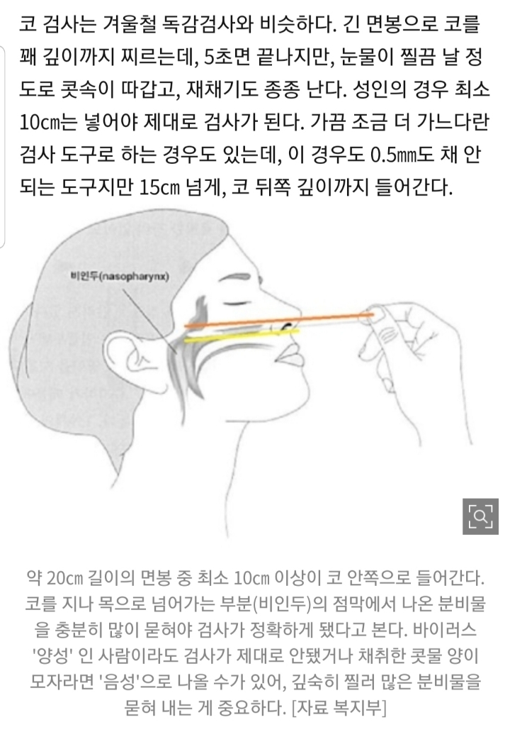 길이 20㎝ 면봉을 코·입에 쑥···코로나 검사, 이렇게 한다 | 인스티즈
