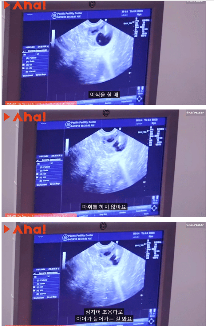 사랑하는 남자는 없지만 가정을 갖고 싶었던 중국여성.jpg | 인스티즈