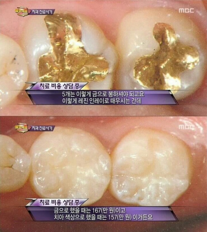 치과의사기꾼들에게 호갱 안 당하는 법 | 인스티즈