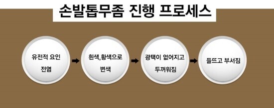 의외로 많은 사람들이 숨기고 있는 질병 | 인스티즈