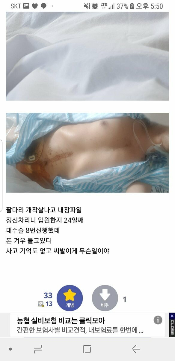 사고로 병원에서 눈떠보니 24일이 흘렀다는 디씨인 | 인스티즈
