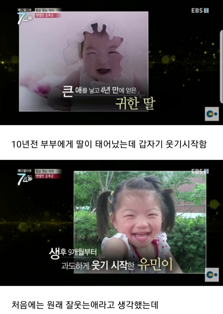 평생 웃으면서 살아야 하는 병 | 인스티즈