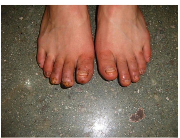 한의학 치료 레전드.jpg | 인스티즈