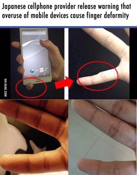장시간 스마트폰 사용으로 인한 손가락 변형 | 인스티즈