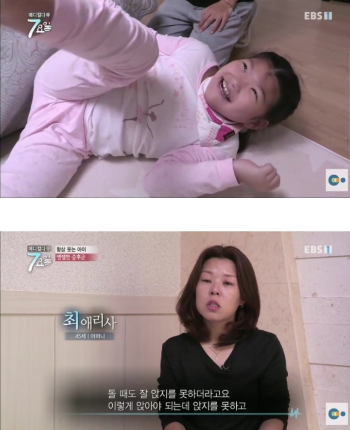 평생 웃으면서 살아야 하는 병 | 인스티즈