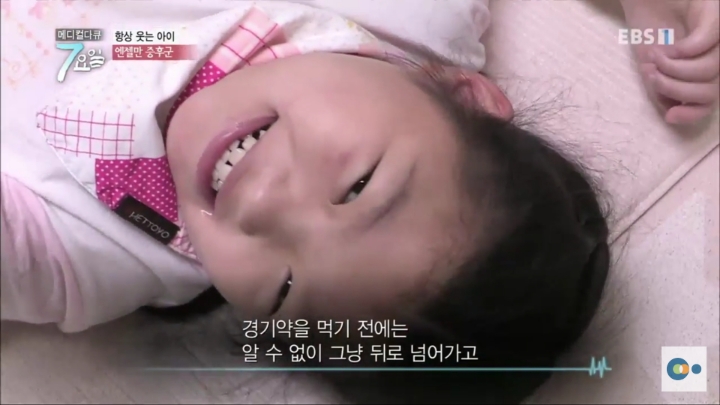 평생 웃으면서 살아야 하는 병 | 인스티즈