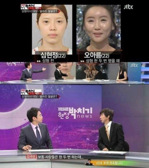 얼굴을 한 두 번 건드리면 안되는 이유 | 인스티즈