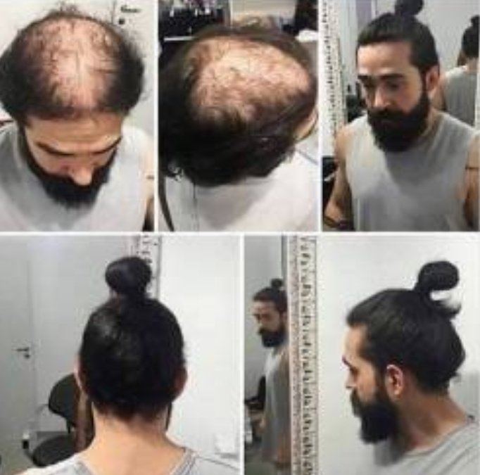 베일이 머리 묶는 이유 | 인스티즈