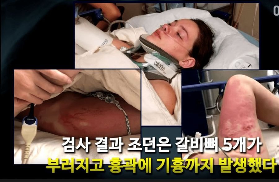 주의) 18미터 높이 다리에서 친구를 장난으로 밀었음; | 인스티즈