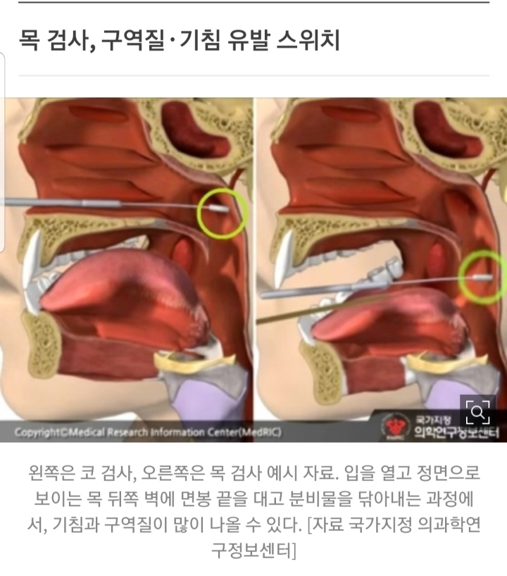 길이 20㎝ 면봉을 코·입에 쑥···코로나 검사, 이렇게 한다 | 인스티즈