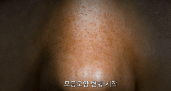 수면이 외모에 미치는 영향 | 인스티즈