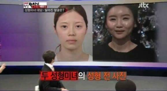 얼굴을 한 두 번 건드리면 안되는 이유 | 인스티즈