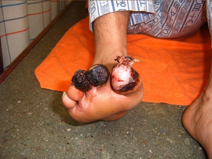 한의학 치료 레전드.jpg | 인스티즈