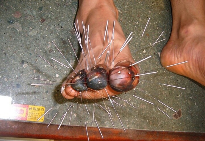 한의학 치료 레전드.jpg | 인스티즈