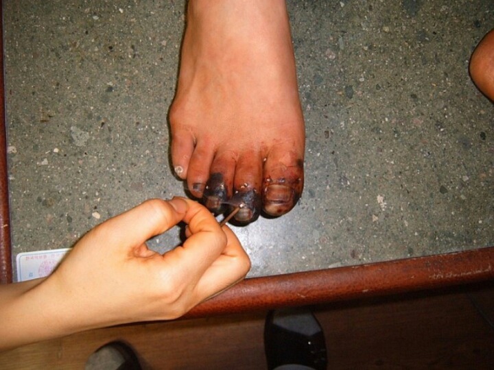 한의학 치료 레전드.jpg | 인스티즈