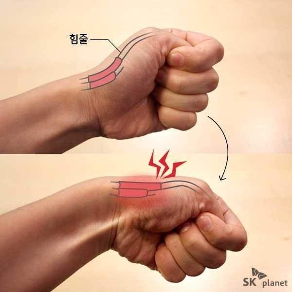 디씨인의 시원하다 못해 추워지는 뾰루지 해결법 | 인스티즈