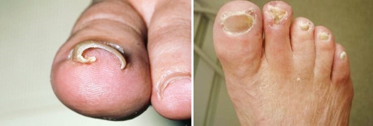 의외로 많은 사람들이 숨기고 있는 질병 | 인스티즈